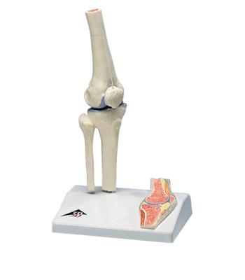 3B Scientific Anatomical Model - mini knee joint with cross section of bone on base - Includes 3B Smart Anatomy