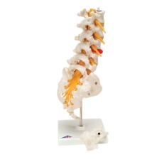 3B Scientific Anatomical Model - lumbar spinal column with dorso-lateral prolapsed disc - Includes 3B Smart Anatomy