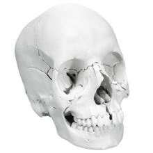 3B Scientific Anatomical Model - anatomical skull, Beauchene 22-part - Includes 3B Smart Anatomy