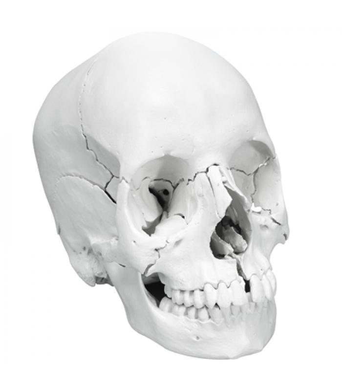 3B Scientific Anatomical Model - anatomical skull, Beauchene 22-part ...