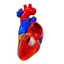 3B Scientific Anatomical Model - heart with bypass, 2-part - Includes 3B Smart Anatomy