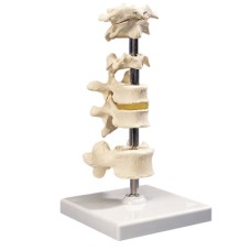 3B Scientific Anatomical Model - 6 mounted vertebrae with removable stand - Includes 3B Smart Anatomy