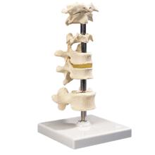 3B Scientific Anatomical Model - 5 mounted vertebrae with removable stand - Includes 3B Smart Anatomy
