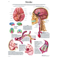 Anatomical Chart - stroke chart, laminated