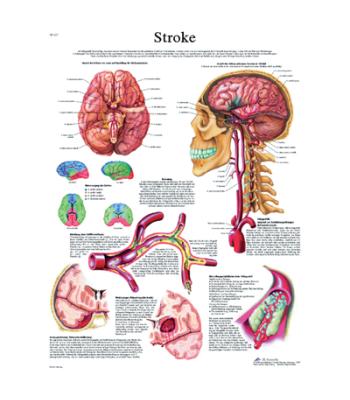 Anatomical Chart - stroke chart paper
