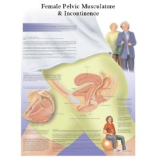 Anatomical Chart - female urinary incontinence chart, laminated