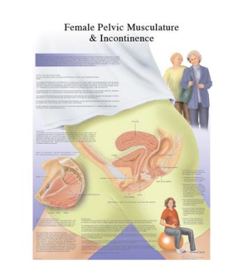 Anatomical Chart - female urinary incontinence chart, laminated
