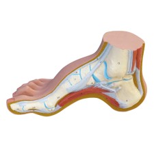3B Scientific Anatomical Model - Hollow Foot (Pes Cavus) - Includes 3B Smart Anatomy