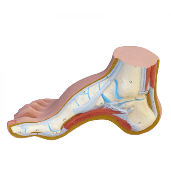 3B Scientific Anatomical Model - Hollow Foot (Pes Cavus) - Includes 3B ...