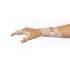 Orfit Classic Pre-Cuts Intrinsic Anti-Spastic Hand Splint, 1/8" mini perforated, medium, case of 2