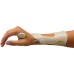Radial Wrist Extension Splint, large