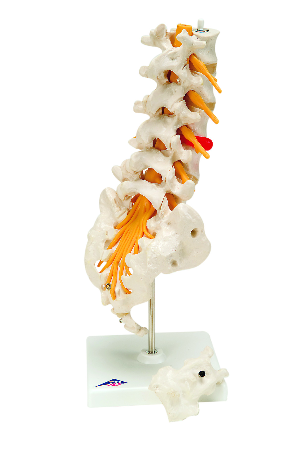 3B Scientific Anatomical Model - lumbar spinal column with dorso-lateral prolapsed disc - Includes 3B Smart Anatomy