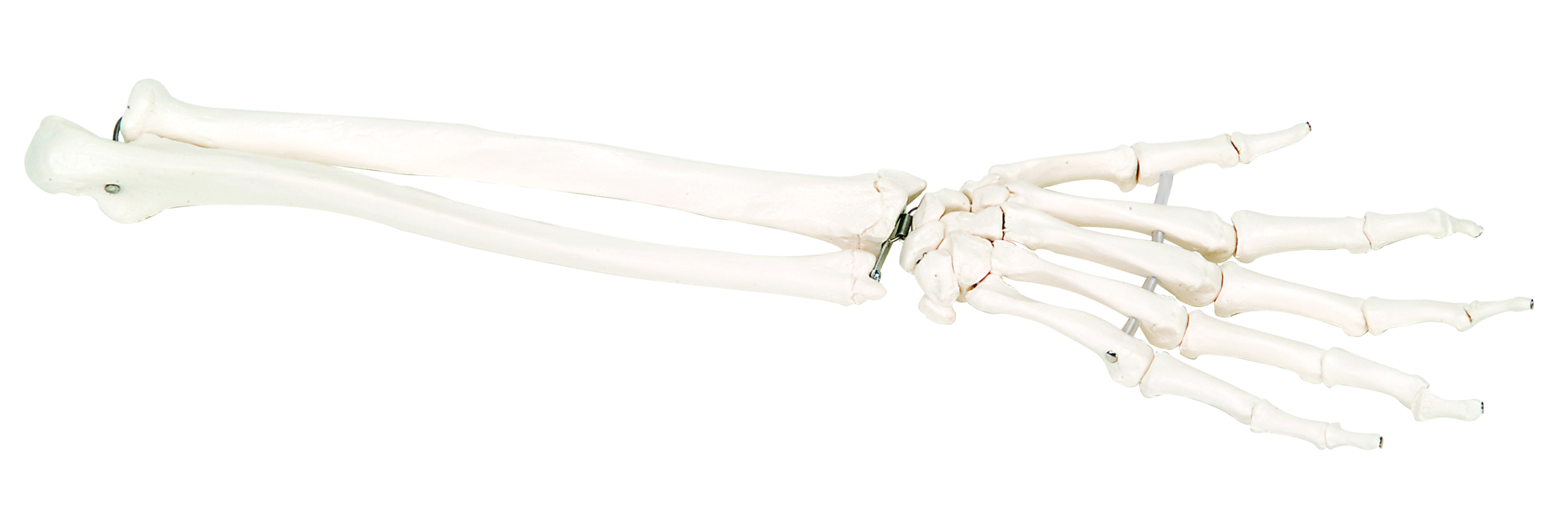 3B Scientific Anatomical Model - loose bones hand skeleton with ulna and radius left (bungee) - Includes 3B Smart Anatomy