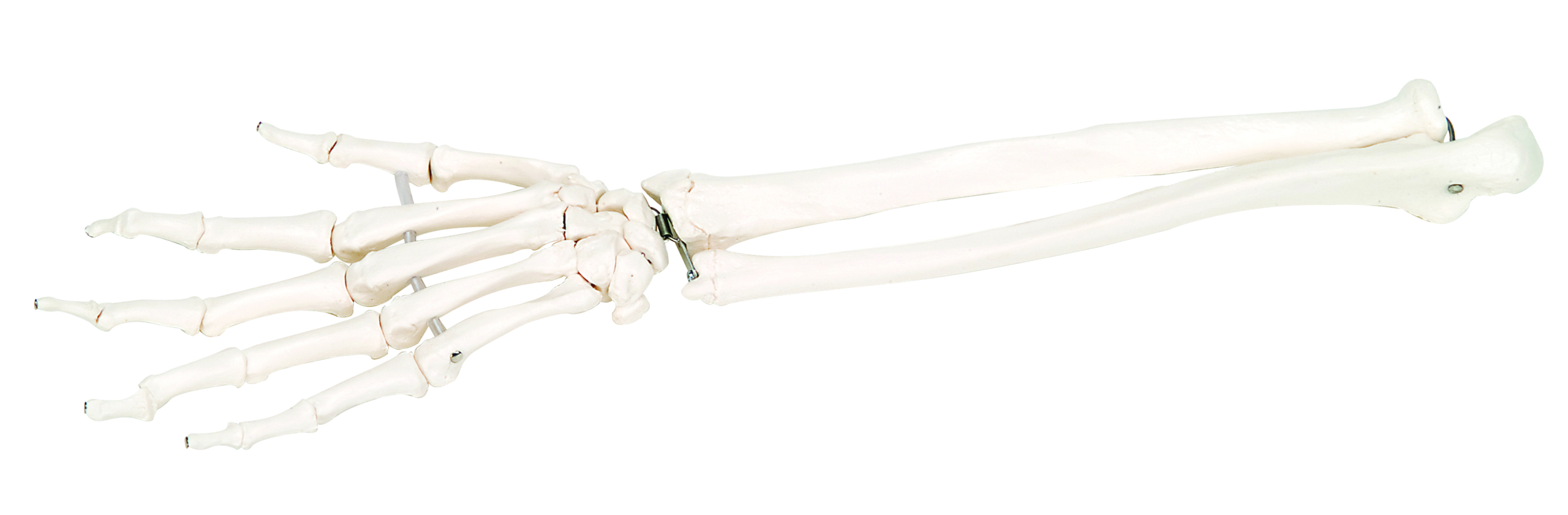 3B Scientific Anatomical Model - loose bones hand skeleton with ulna and radius right (bungee) - Includes 3B Smart Anatomy
