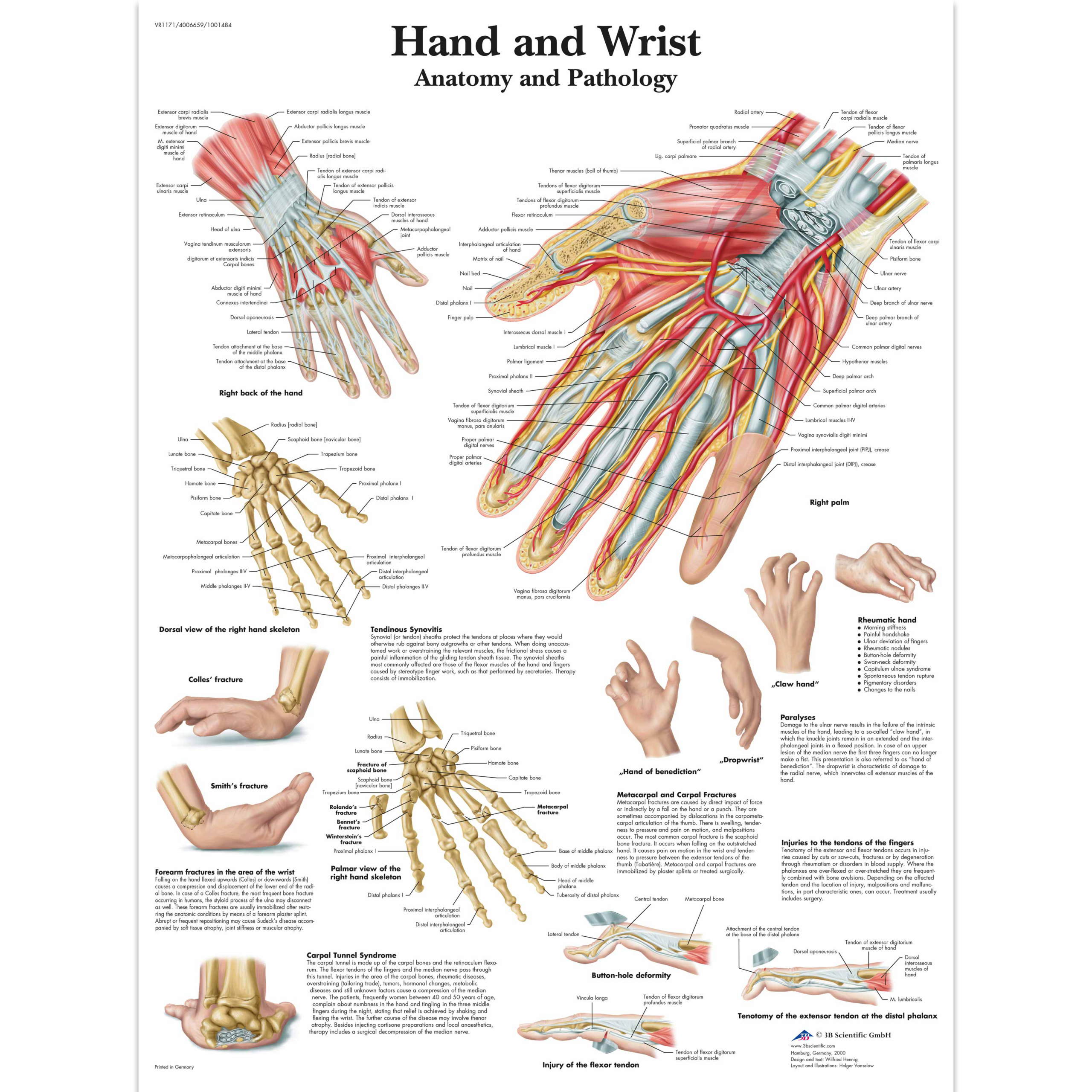 Anatomical Chart - hand & wrist sticky back
