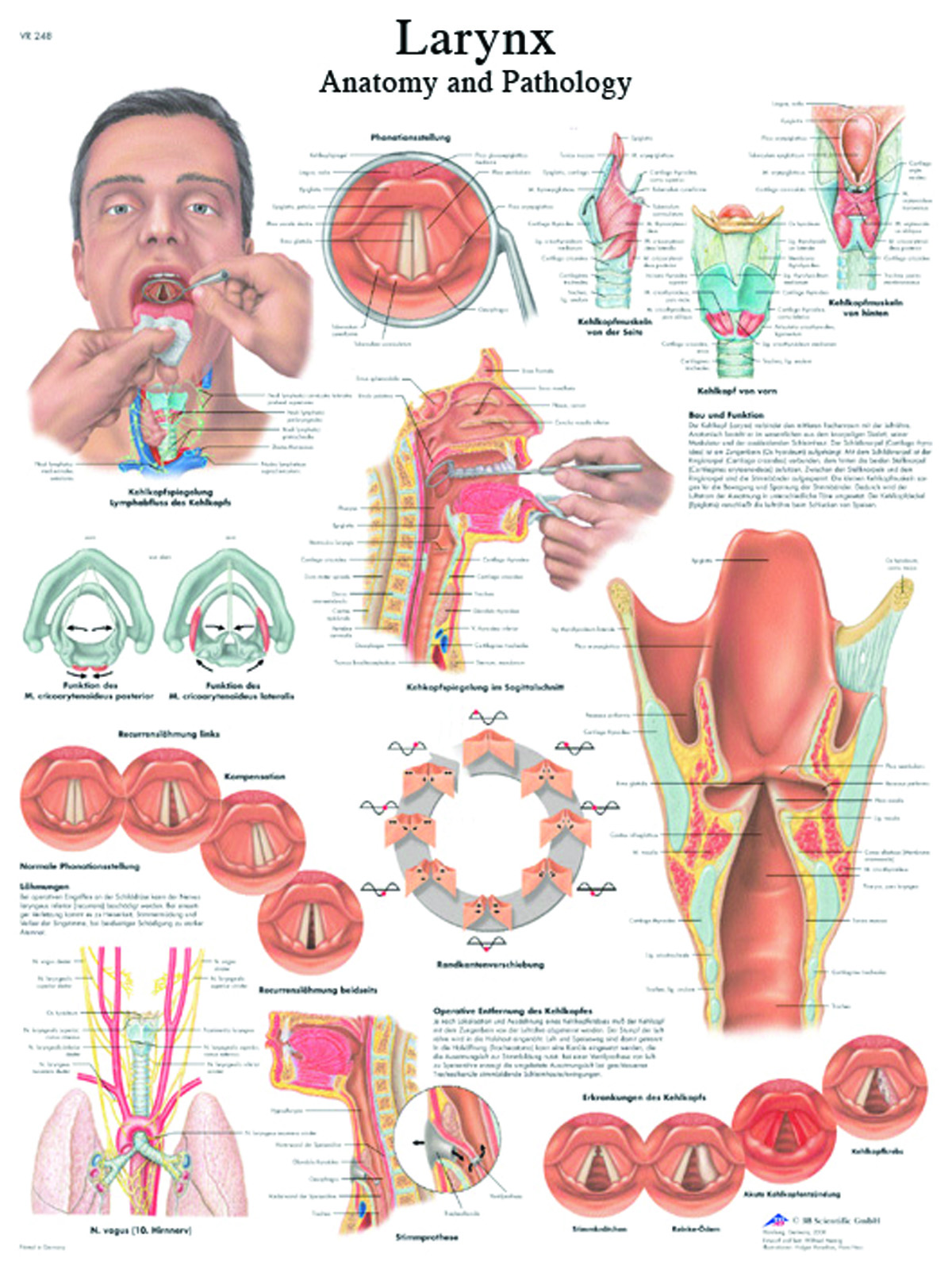 Anatomical Chart - larynx laminated