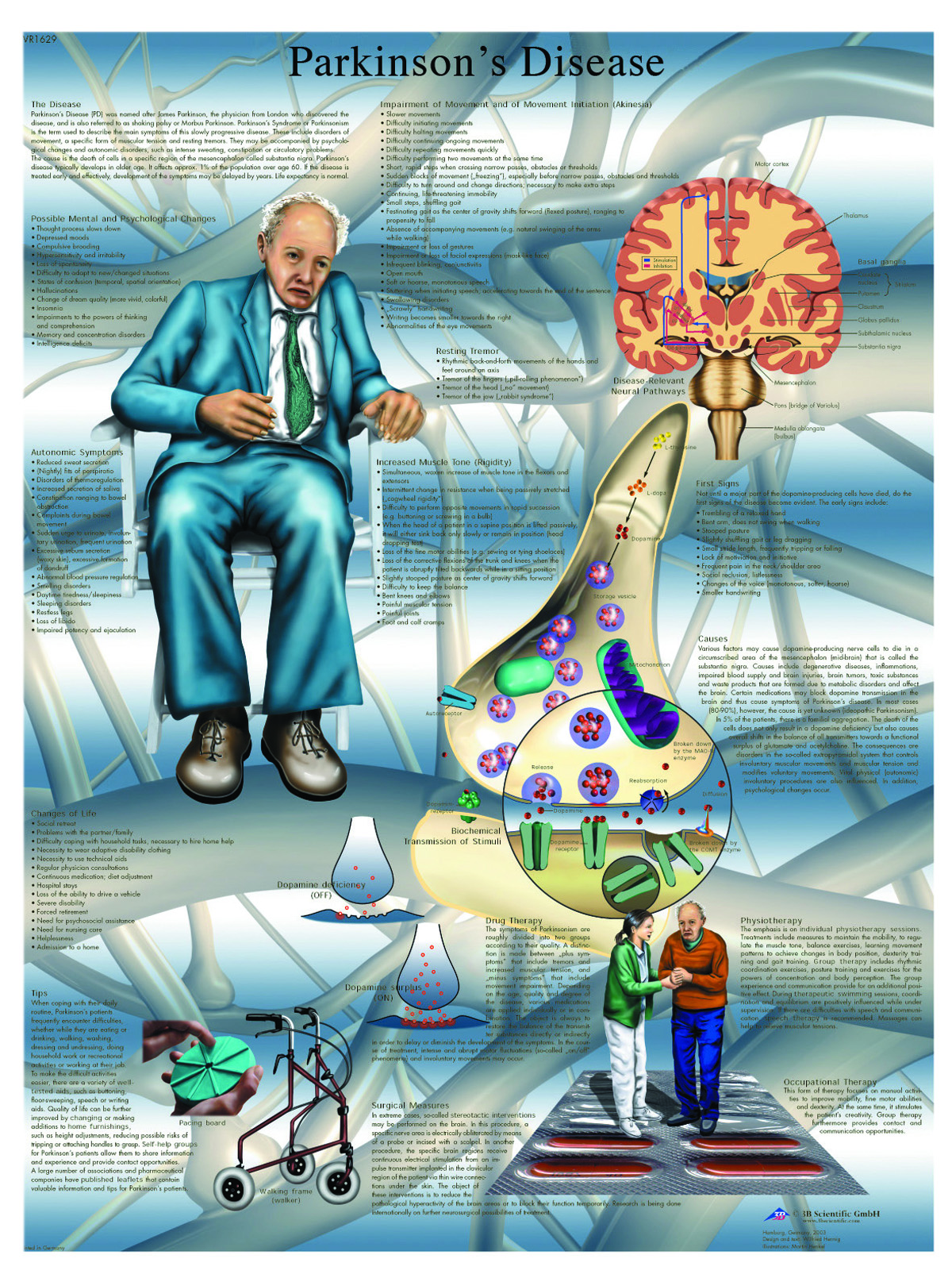 Anatomical Chart - Parkinson's disease laminated