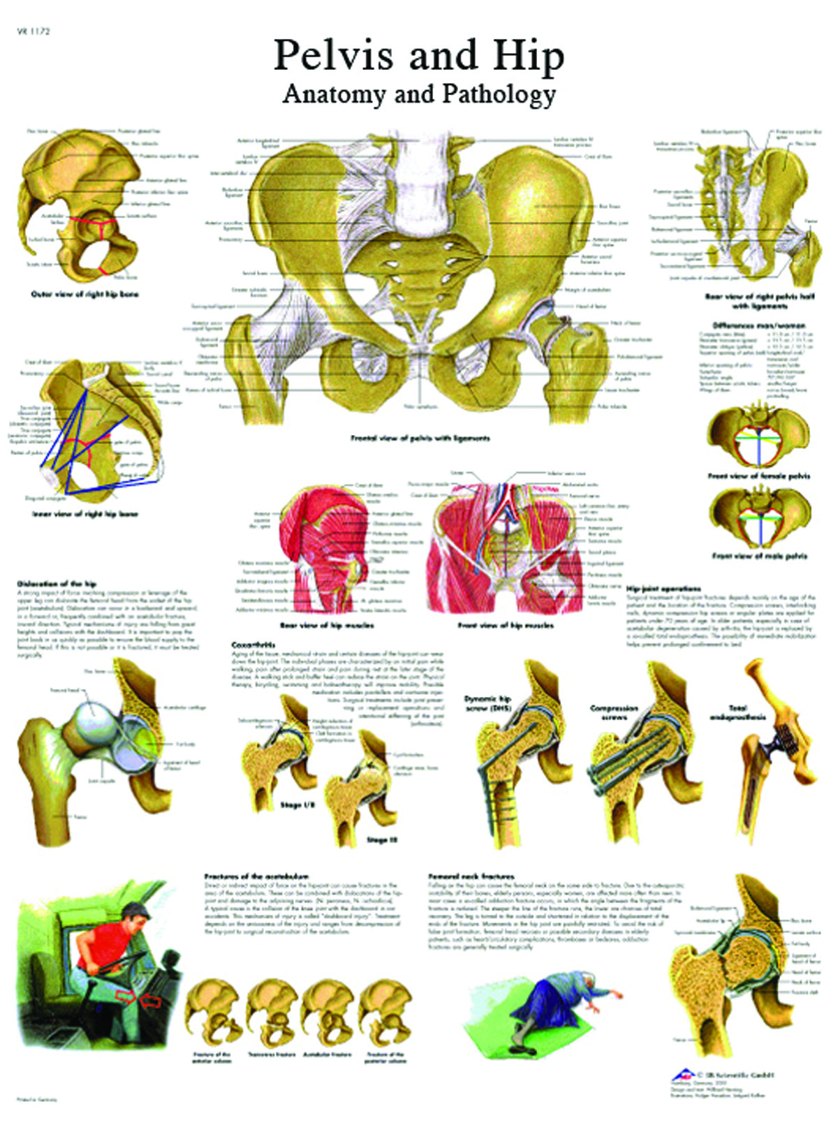 Anatomical Chart - hip & pelvis laminated