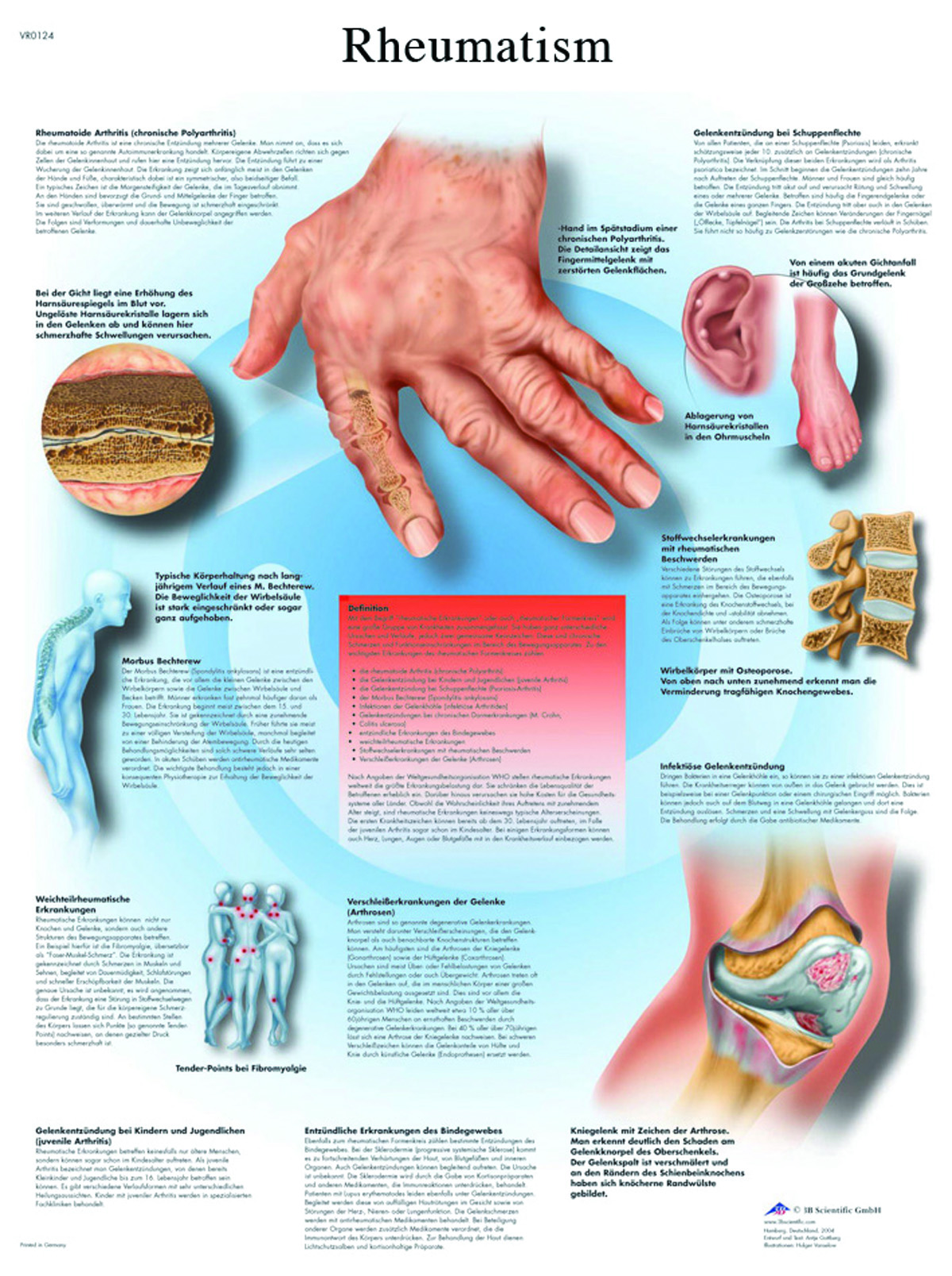 Anatomical Chart - rheumatic diseases paper