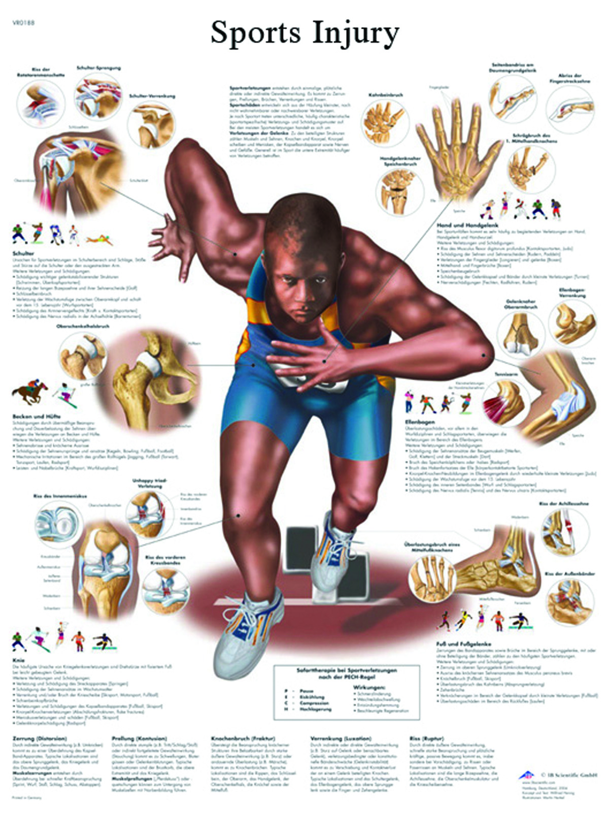 Anatomical Chart - sports injuries paper
