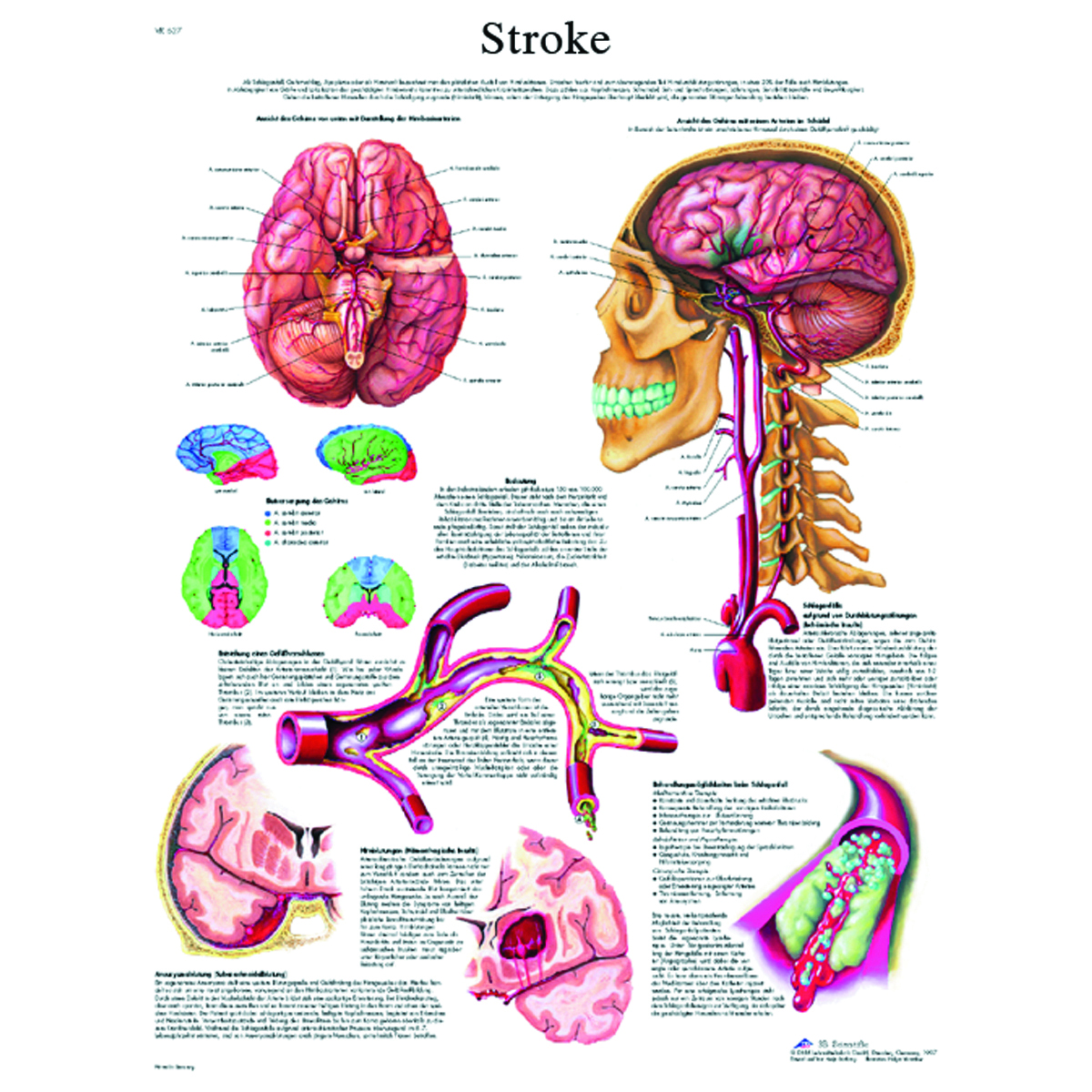 Anatomical Chart - stroke chart paper